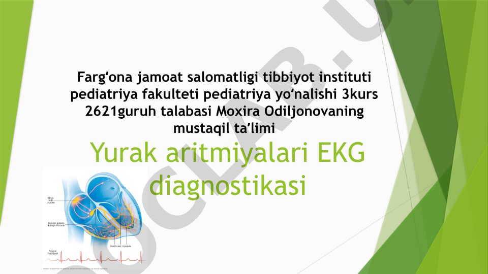 Yurak aritmiyalari va EKG diagnostikasi
