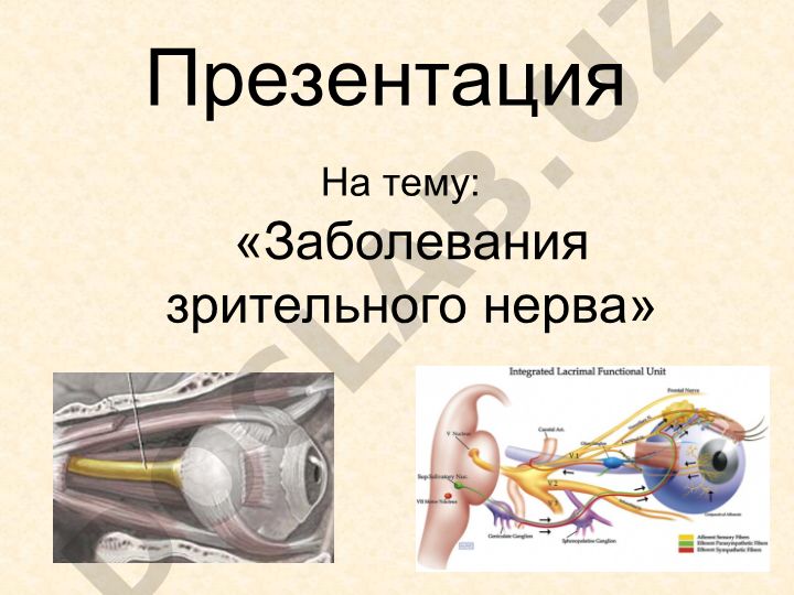 Заболевания зрительного нерва