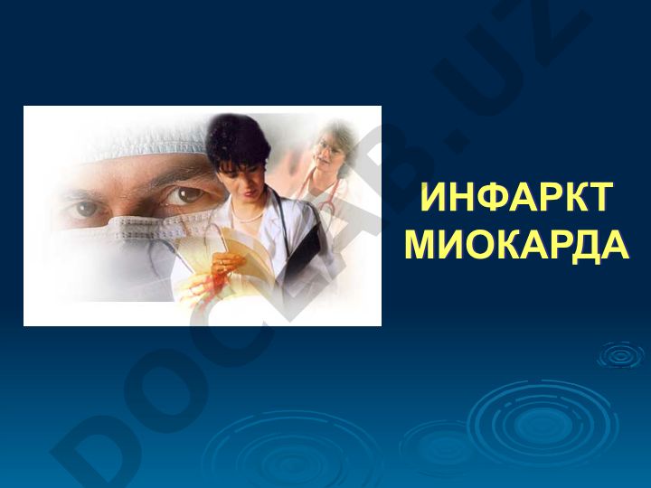 Инфаркт миокарда: распространенность, причины и клинические проявления