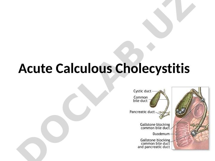 Acute Calculous Cholecystitis Clinical Problem