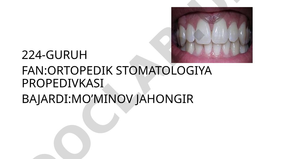 Tish nuqsonlarining xalqaro tasnifi va bo'shliqlar joylashgan joyning harf bilan belgilash
