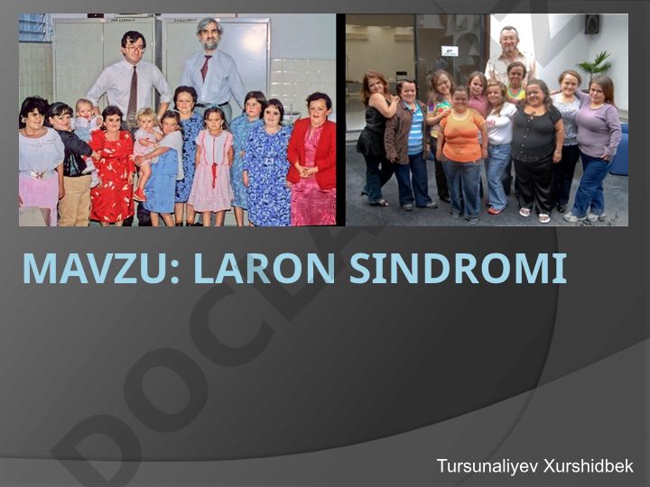 Laron Sindromi