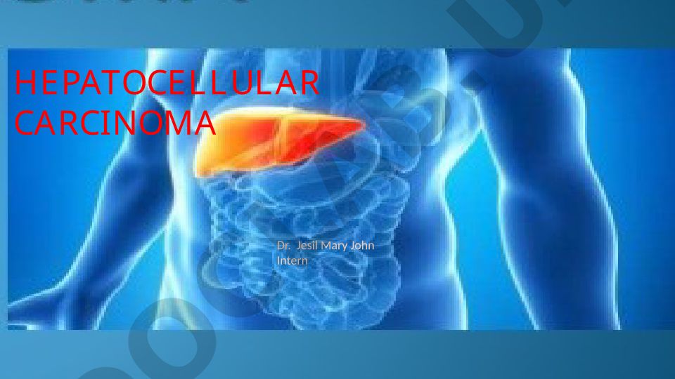 Hepatocellular Carcinoma