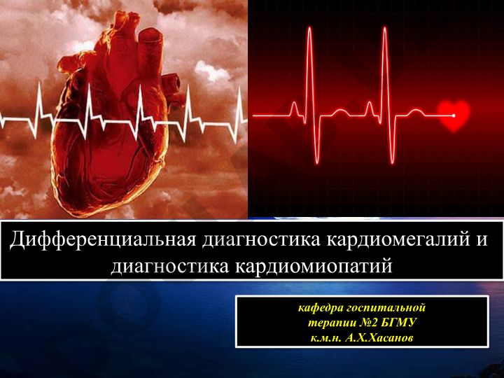 Дифференциальная диагностика кардиомегалий и кардиомиопатий