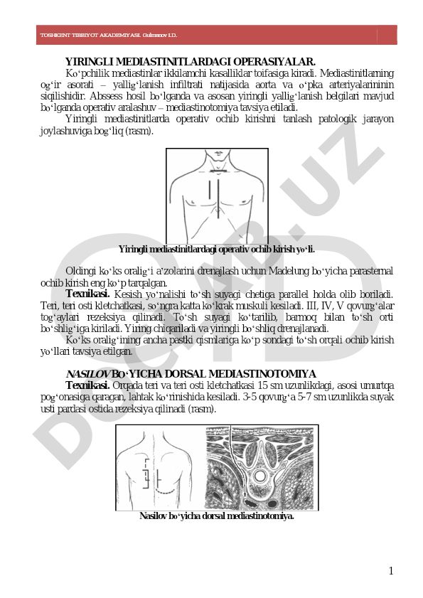Yiringli mediastinitlardagi operasiyalar