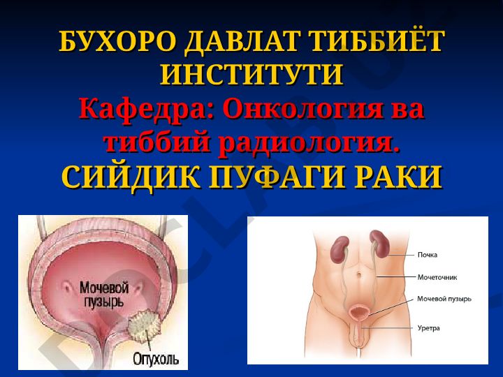 Сийдки пуфаги раки
