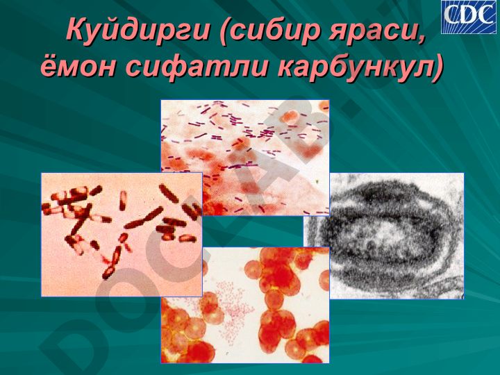 Куйдирги (сибирская язва): этиология, эпидемиология, клиника, диагностика, лечение и профилактика