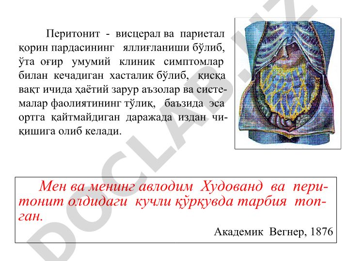 Перитонит: этиология, классификация и клинические признаки
