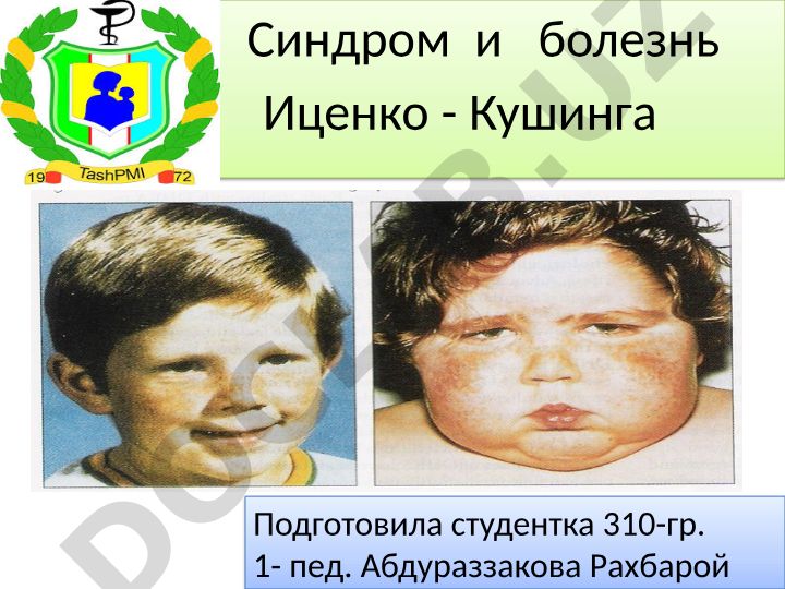 Синдром и болезнь Иценко-Кушинга