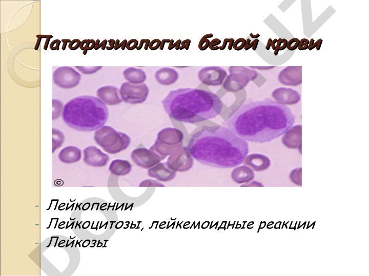 Патофизиология белой крови: лейкопении и лейкоцитозы
