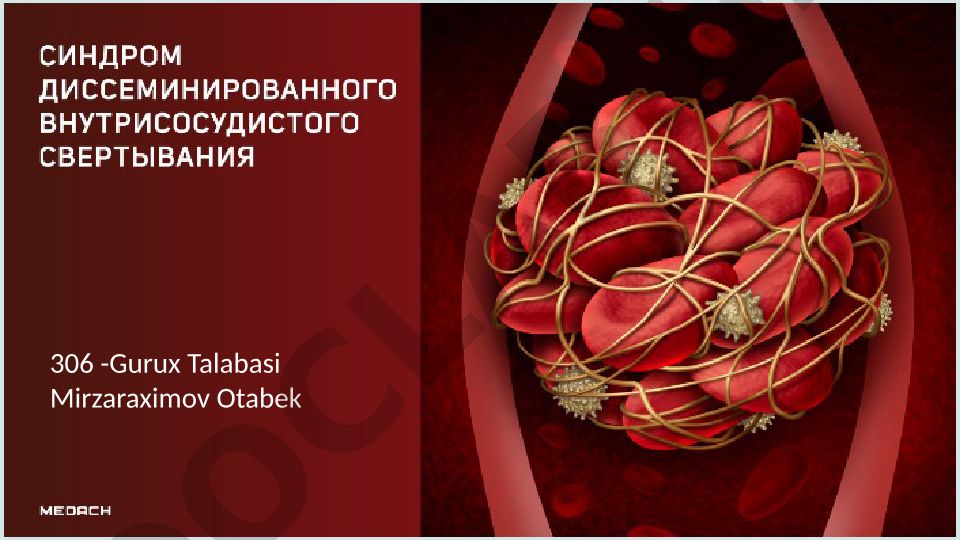 DVS sindromi sabablari, patogenezi, diagnostikasi va davolash