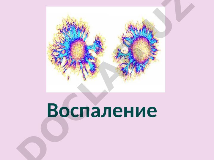 Воспаление: патологический процесс и его патогенез