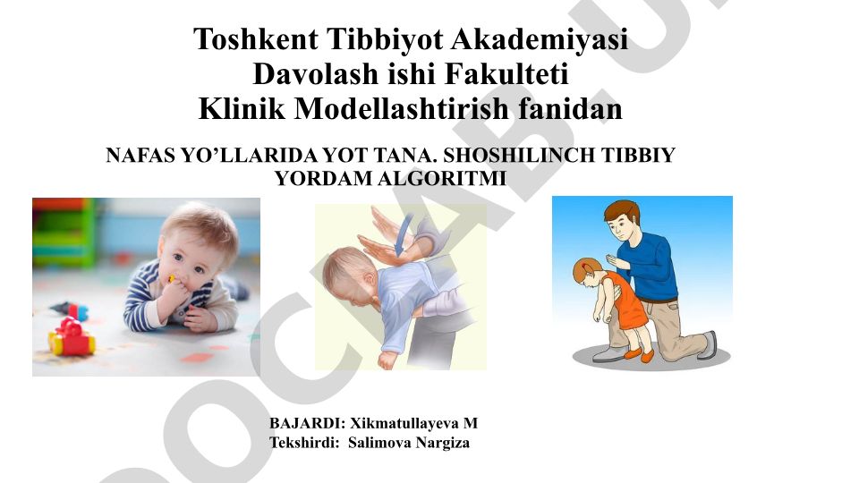 Nafas yoʻllariga yot jism tushishi belgilari va birinchi yordam algoritmi