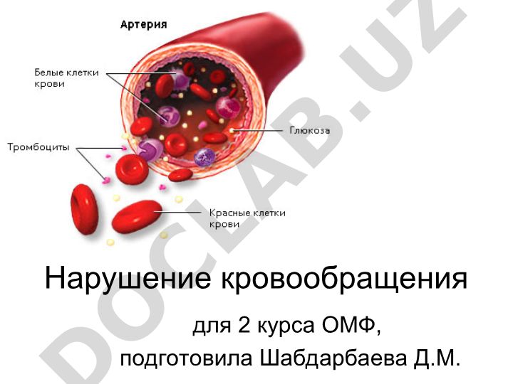 Нарушение кровообращения: классификация и виды