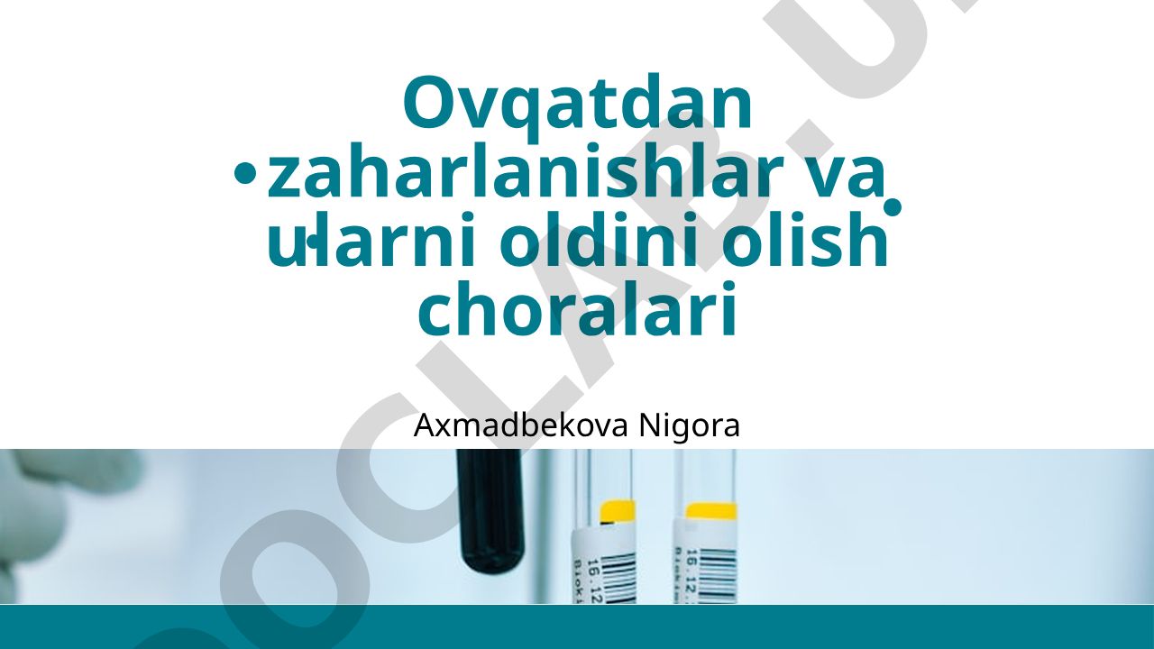 Ovqatdan zaharlanishlar va ularni oldini olish choralari