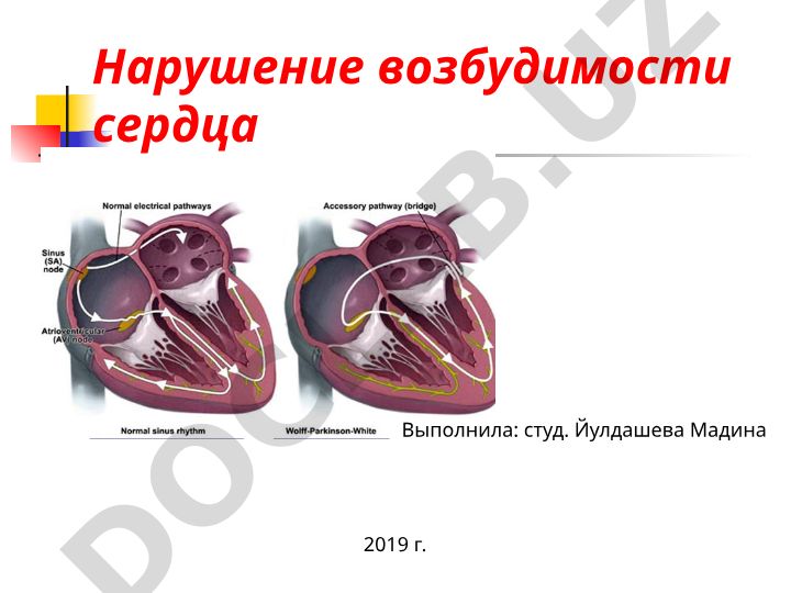 Нарушение возбудимости сердца