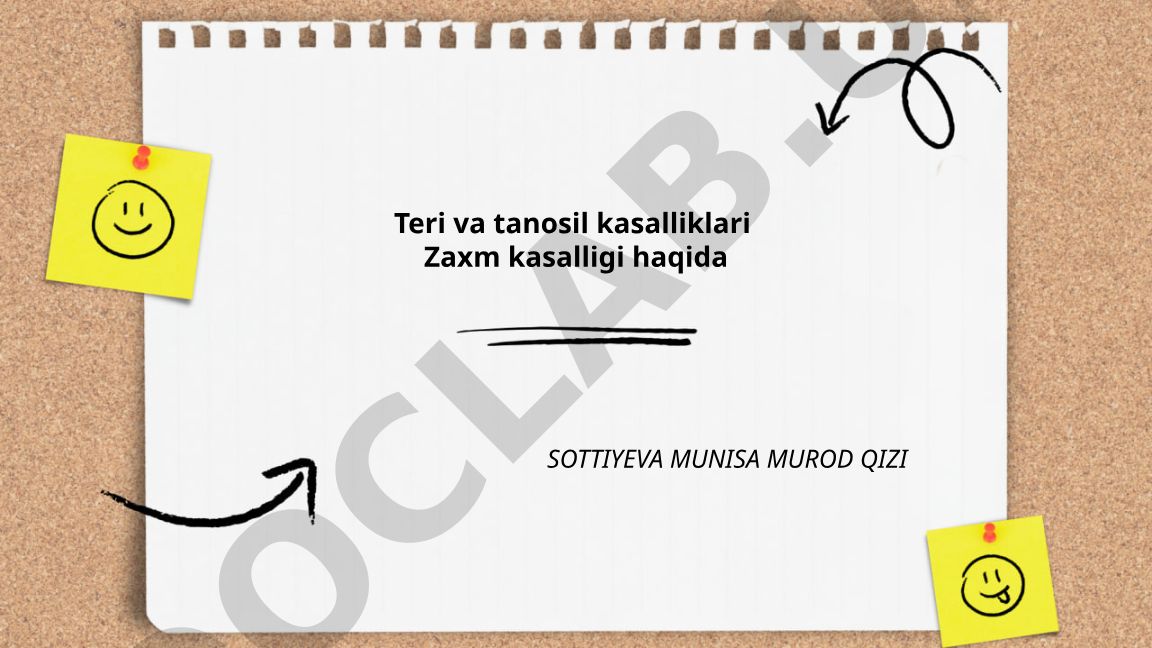 Zaxm kasalligi: ta'rif, etiologiya, klinik belgilar va davolash