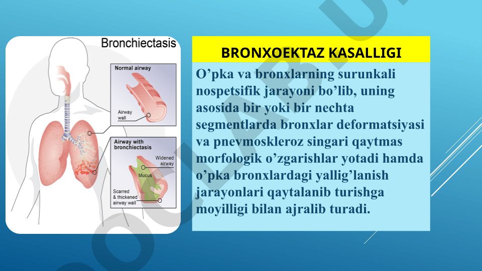 Bronxoektaz kasalligi: etiologiyasi, patogenezi va klassifikatsiyasi