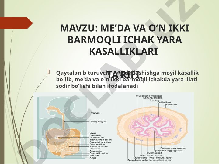 ME’DA VA O’N IKKI BARMOQLI ICHAK YARA KASALLIKLARI TA'RIFI