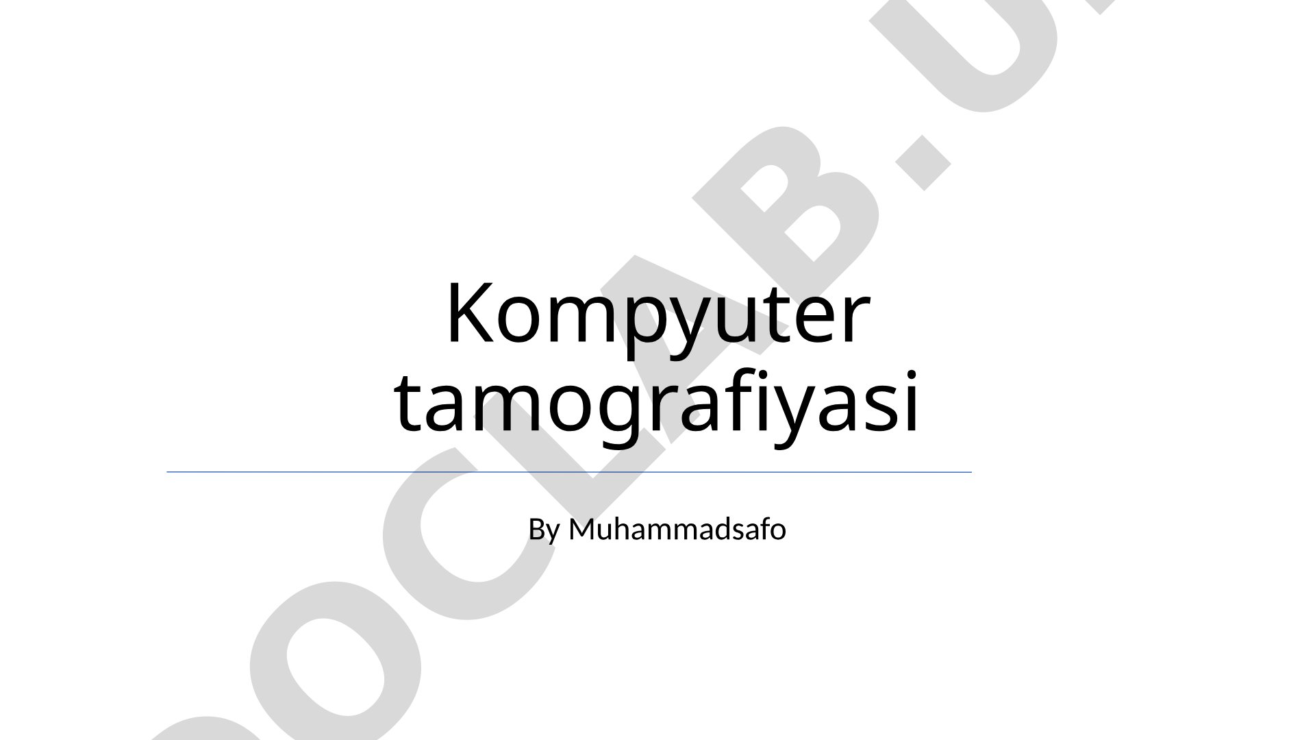 Kompyuter tamografiyasi