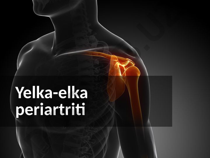 Yelka-elka periartriti (PLP) tashxisi va sabablari