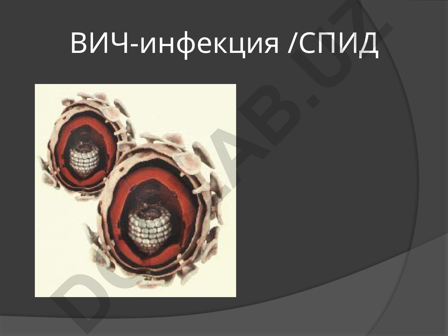 ВИЧ-инфекция и СПИД: распространение, статистика и эпидемиологическая ситуация