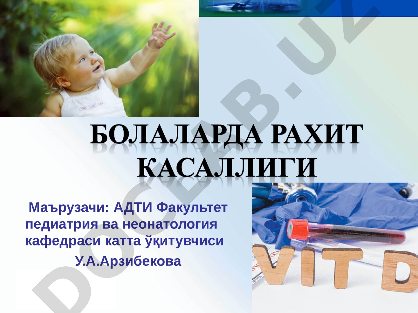 Рахит: этиология, патогенез, классификация, клиника, диагностика, лечение и профилактика