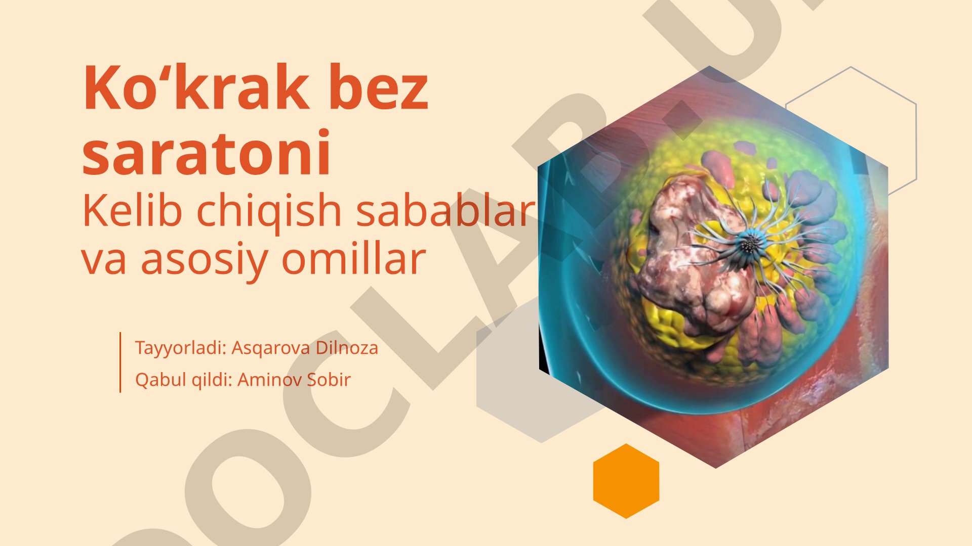 Ko'krak bez saratoni kelib chiqish sabablari va asosiy omillar