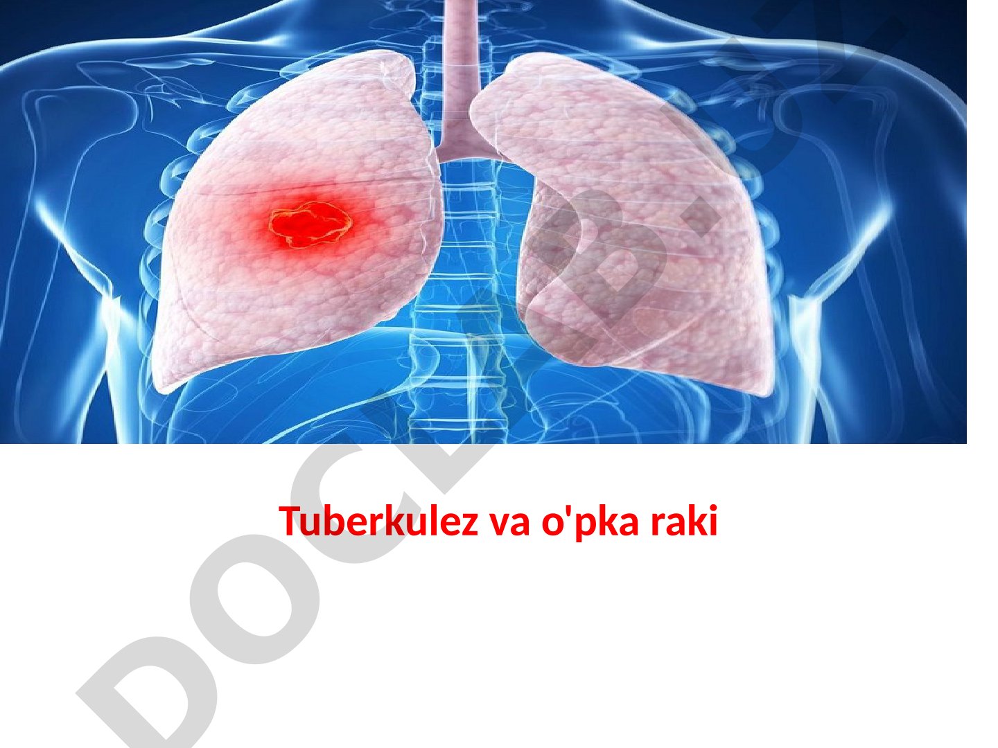 Tuberkulez va o'pka raki klinik ko'rinishi