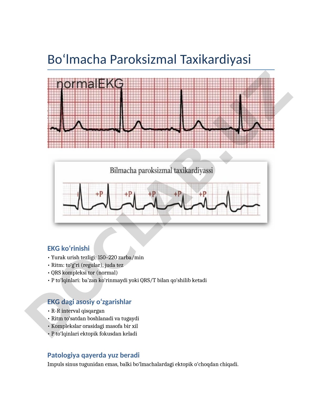 Bo‘lmacha Paroksizmal Taxikardiyasi EKG ko‘rinishi