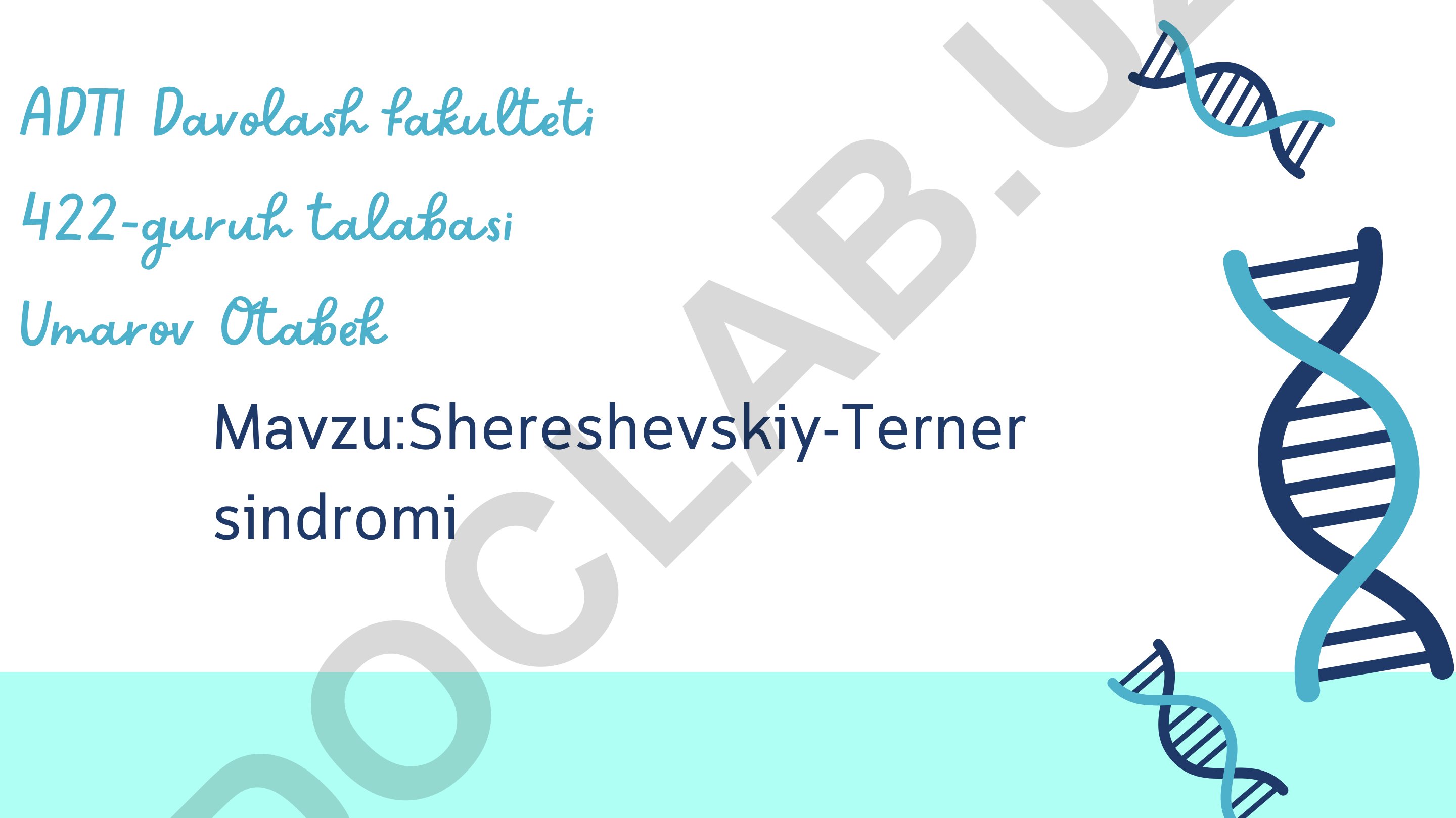 Shereshevskiy-Terner sindromi