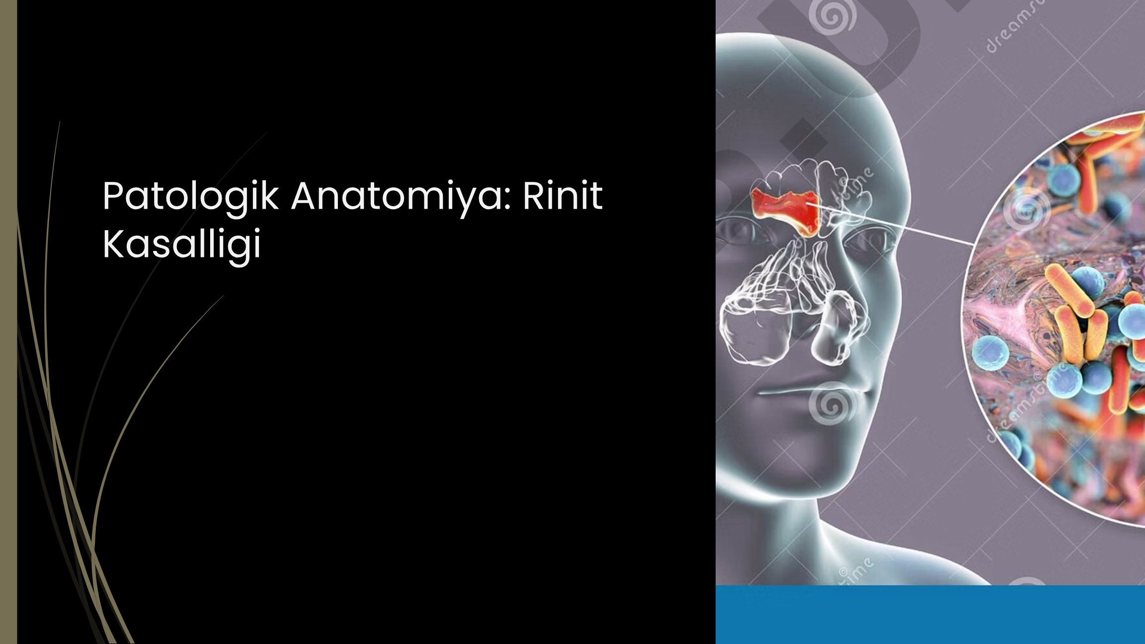 Patologik Anatomiya: Rinit Kasalligi