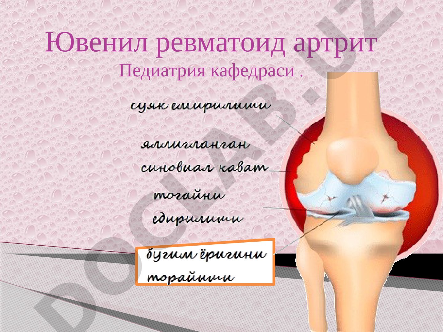 Ювенил ревматоид артрит