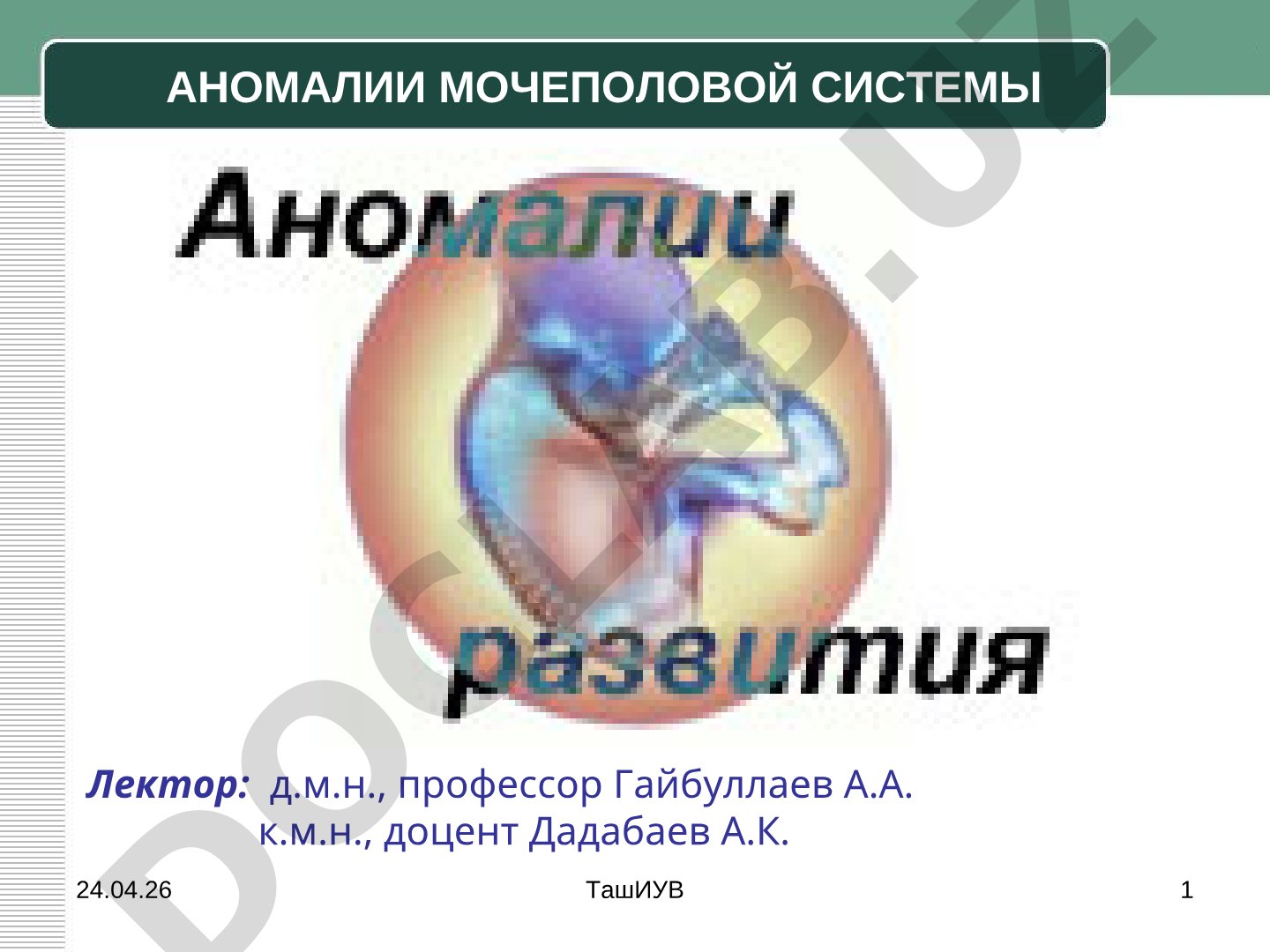 Аномалии мочеполовой системы