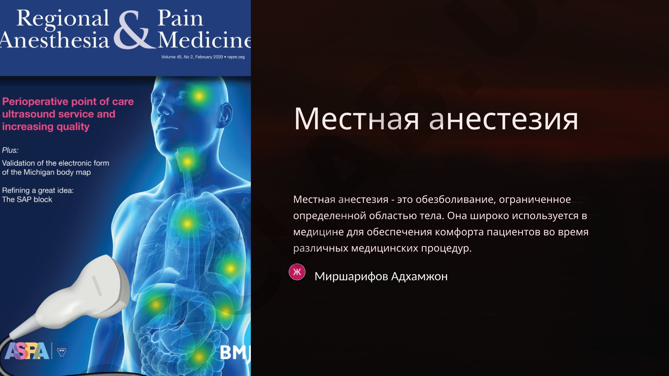 Местная анестезия