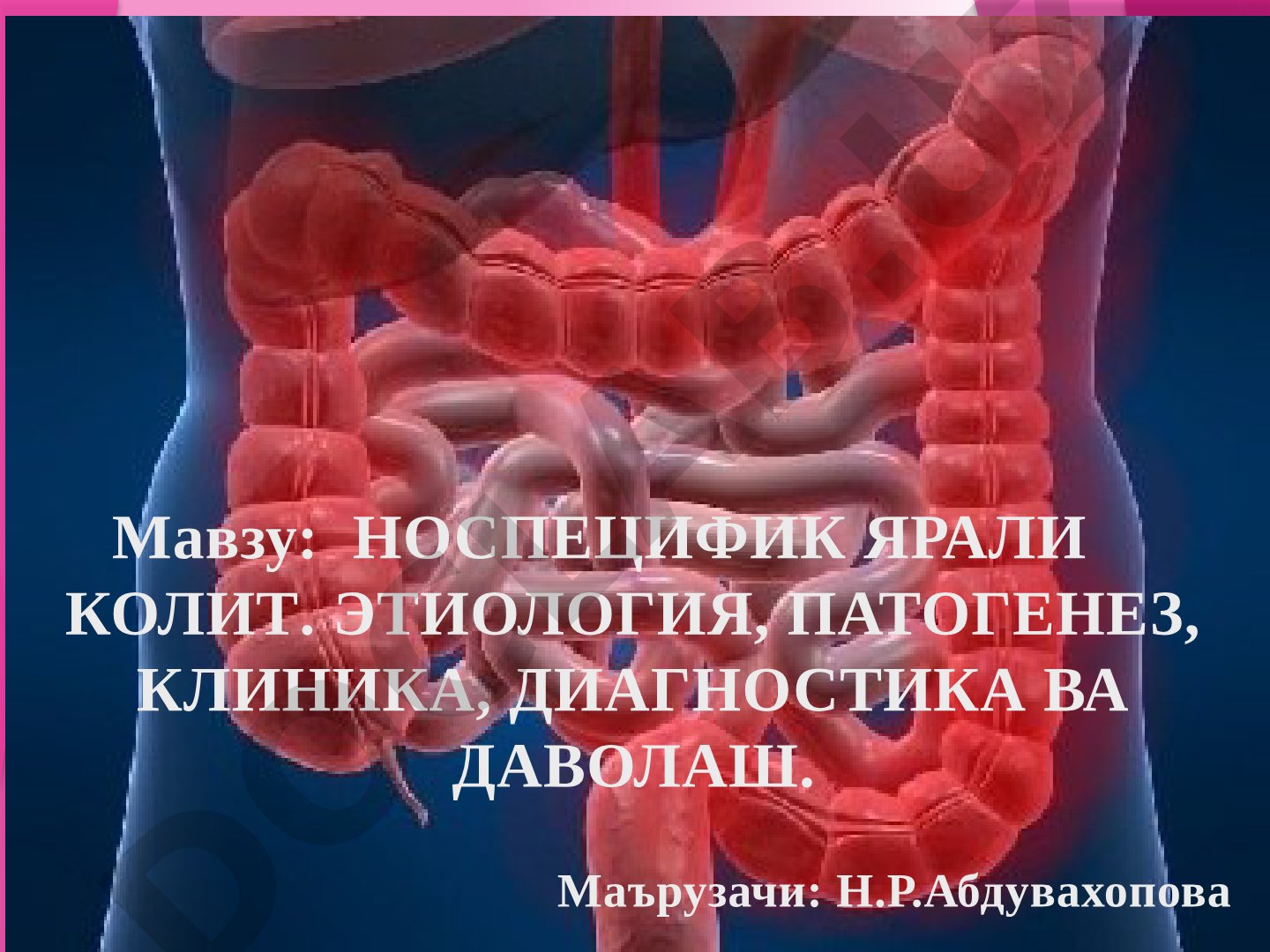 Носпецифик ярали колит. Этиология, патогенез, клиника, диагностика ва даволаш