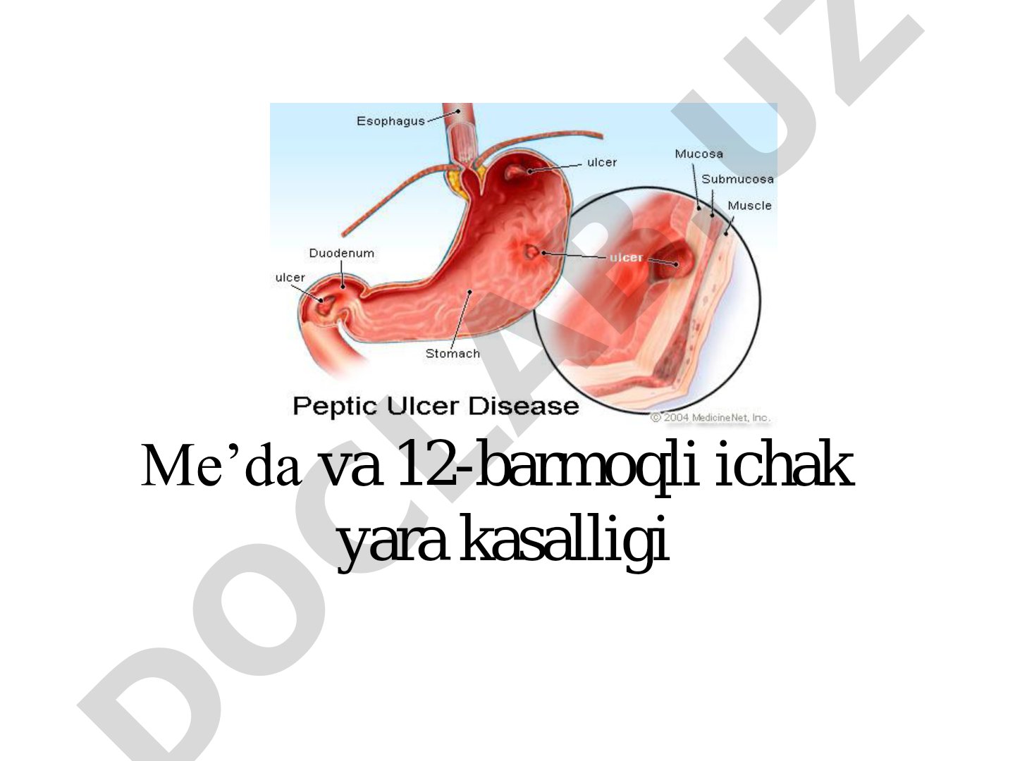 Me'da va 12-barmoqli ichak yara kasalligi tarixiy asoslari