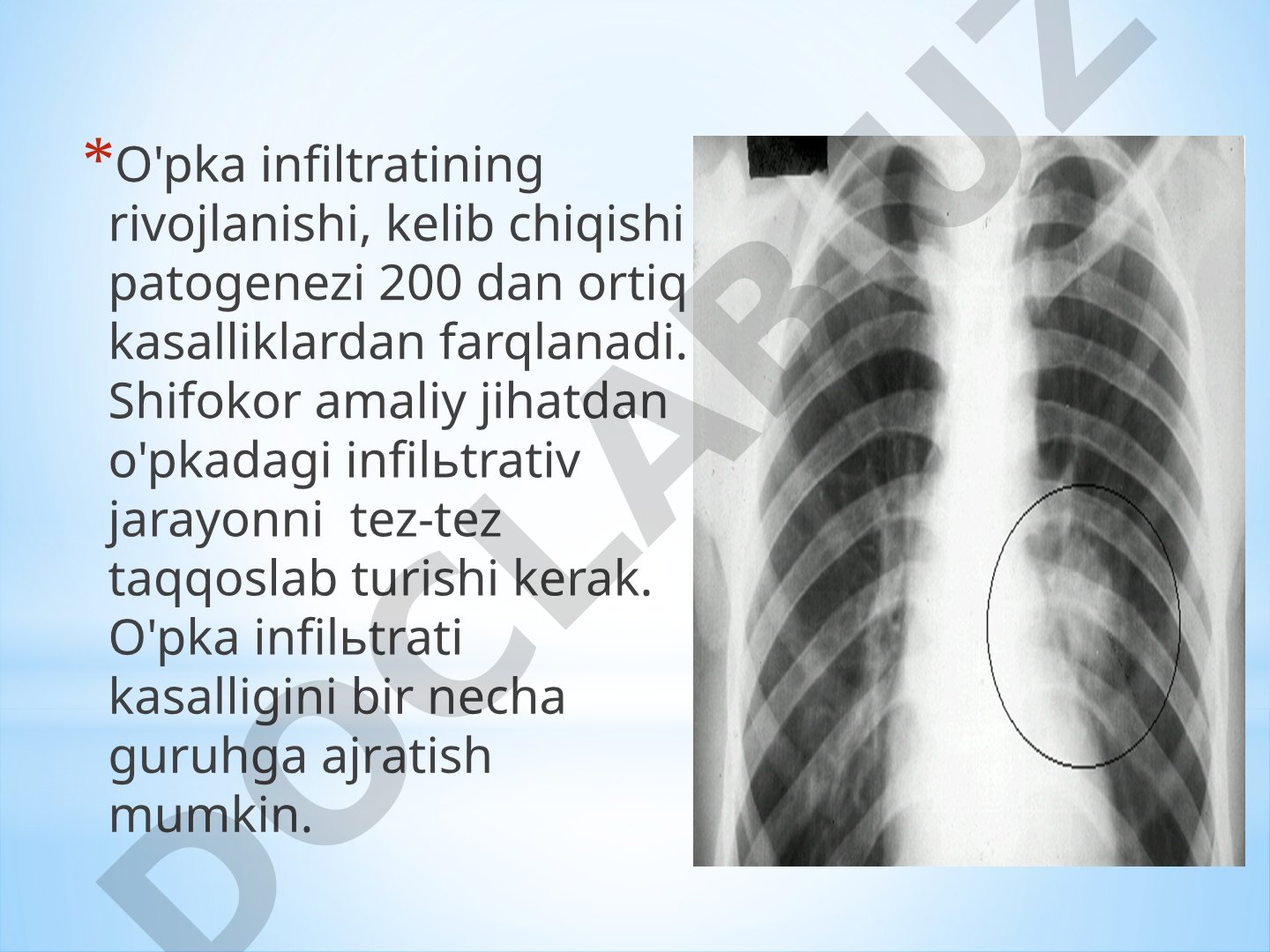 O'pka infiltratining rivojlanishi va patogenezi