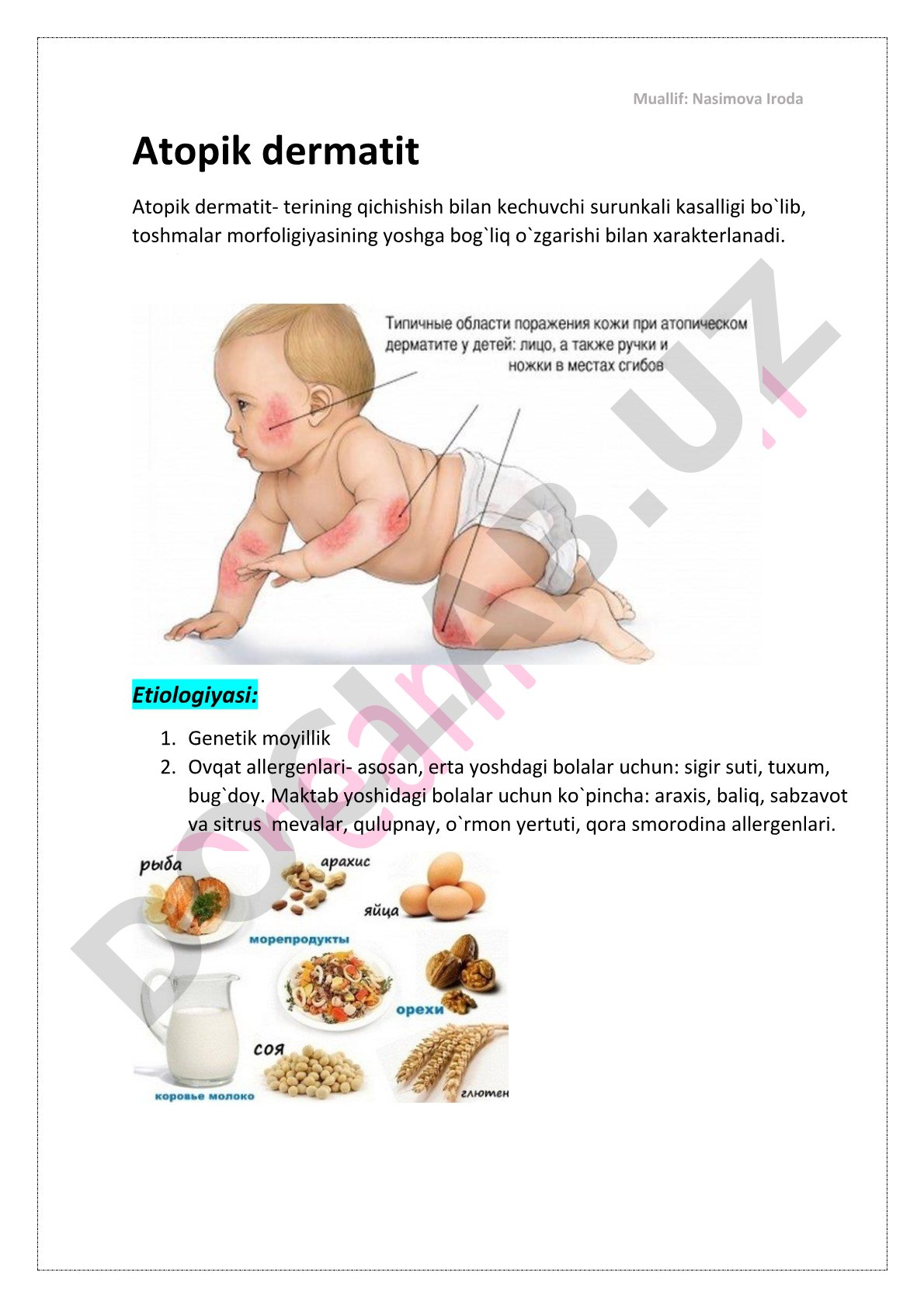 Atopik dermatitning etiologiyasi va patogenezi