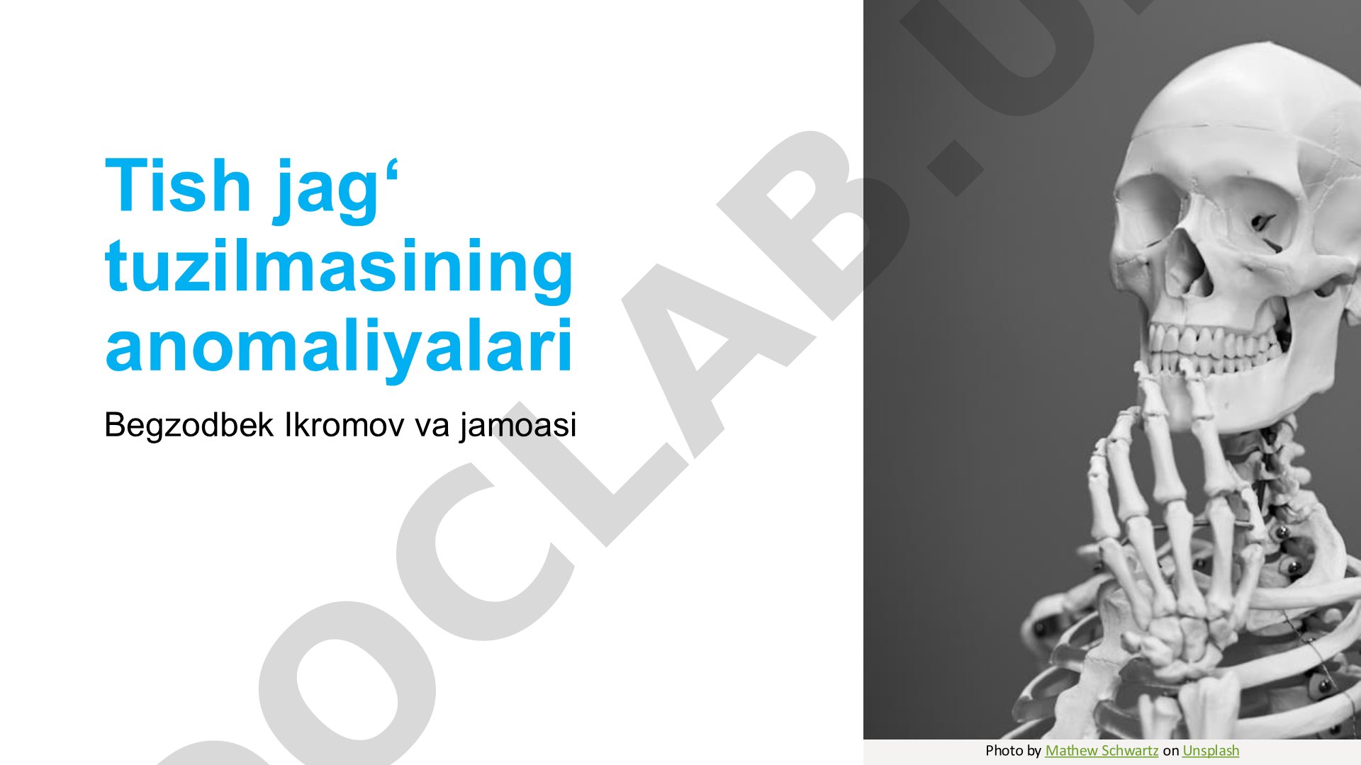 Tish jagʻ tuzilmasining anomaliyalari