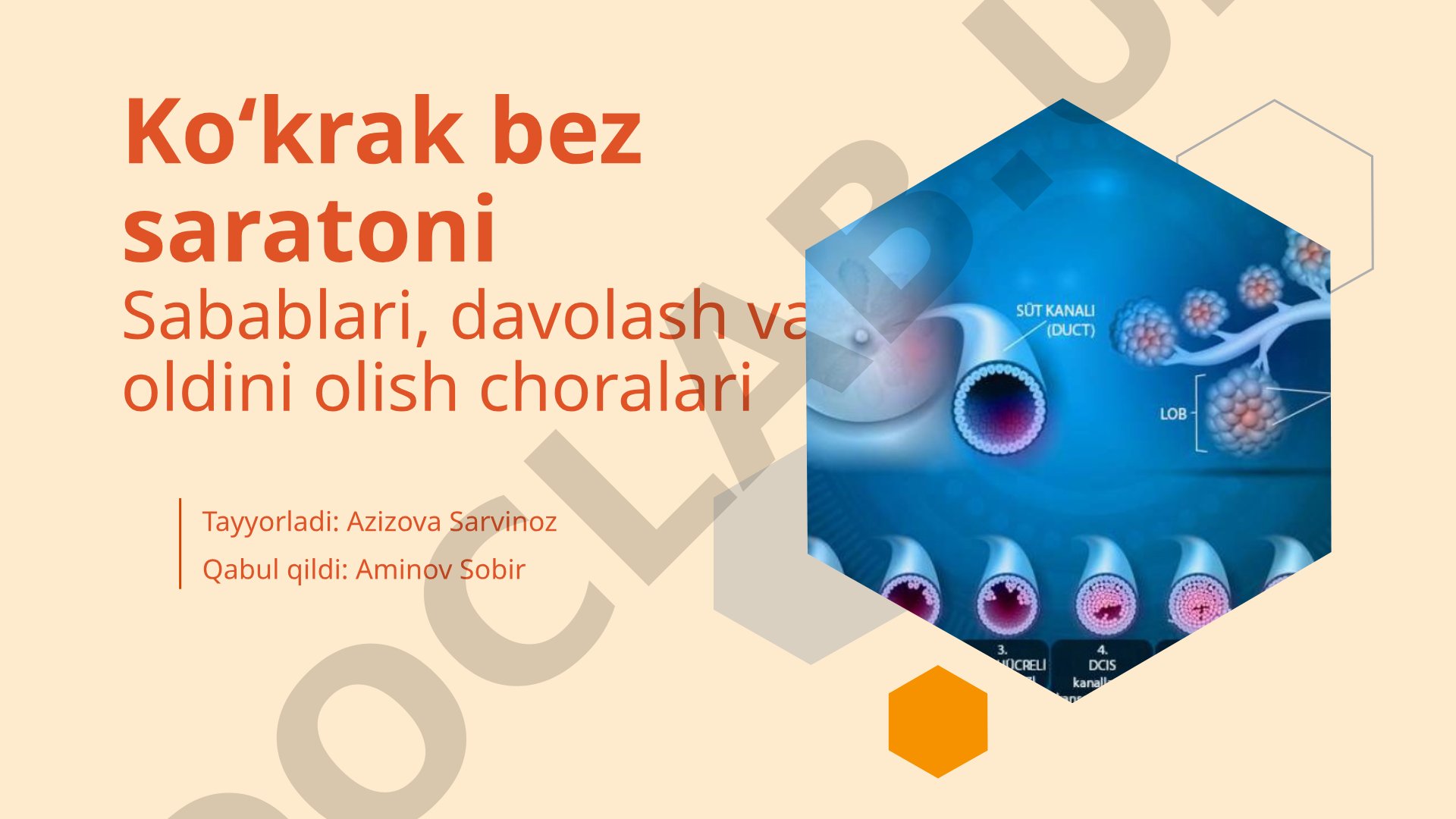 Ko'krak bez saratoni sabablari, davolash va oldini olish choralari