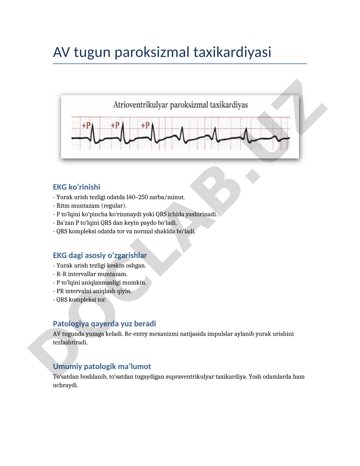 AV tugun paroksizmal taxikardiyasi EKG ko‘rinishi