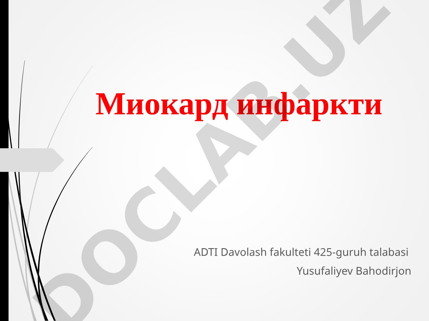 Миокард инфаркти