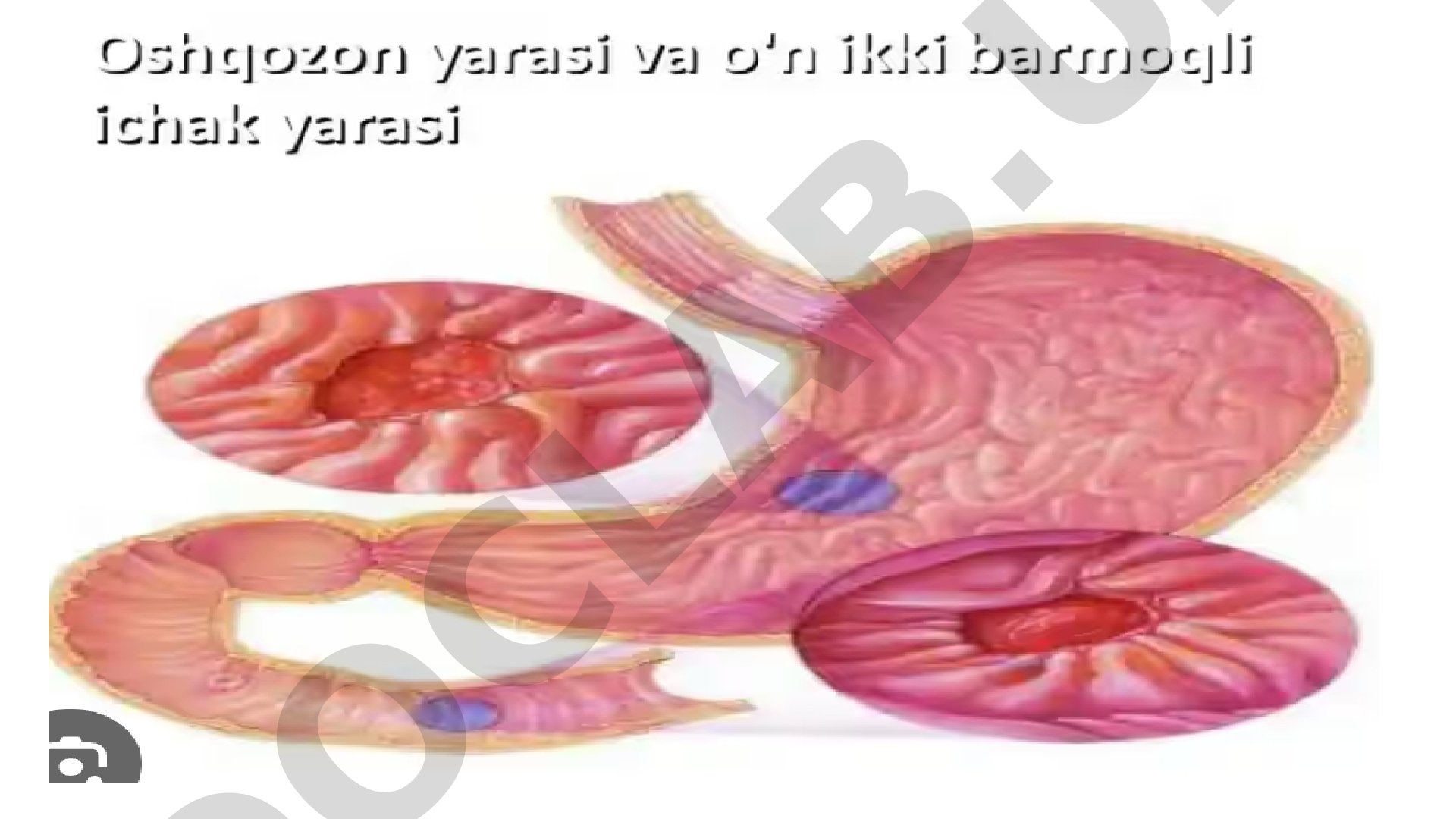 Raqamli tasvirlar to'plami