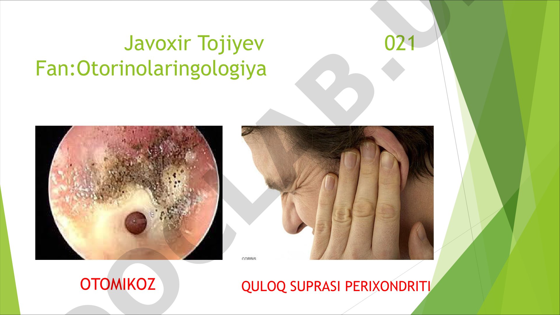 Otomikoz quloq suprasi perixondriti