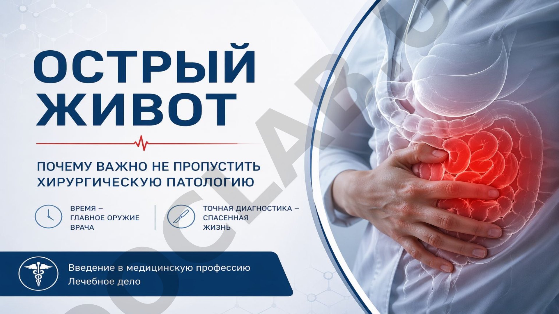 Острый живот
