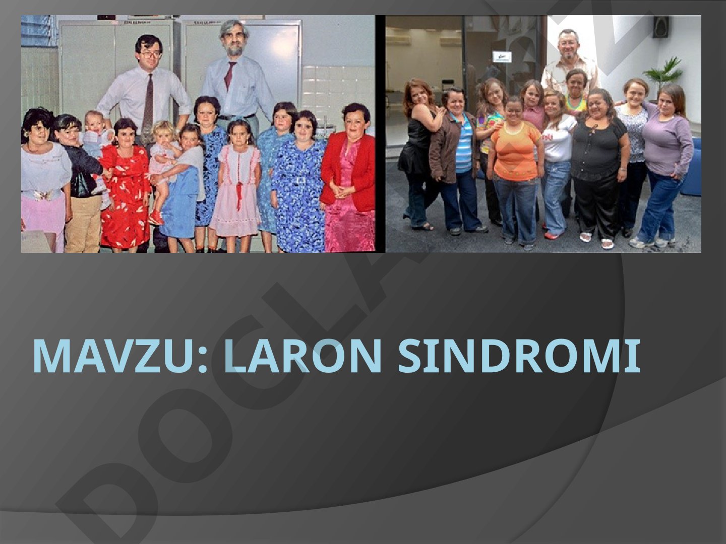 Laron sindromi - o'sish gormoni retseptorlari genidagi nuqsonlar natijasida paydo
