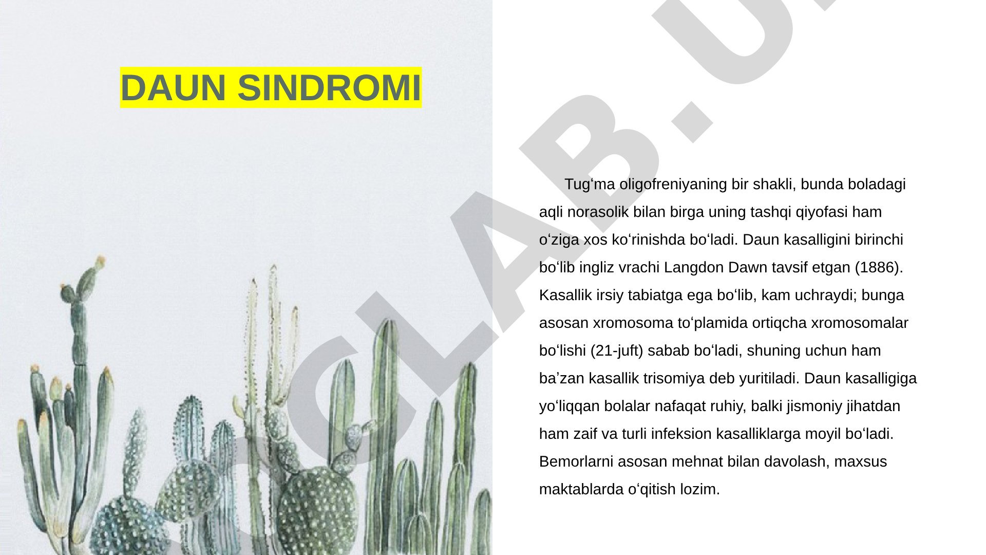 Daun sindromi haqida ma'lumot, uning belgilari, sabablari va tarixi