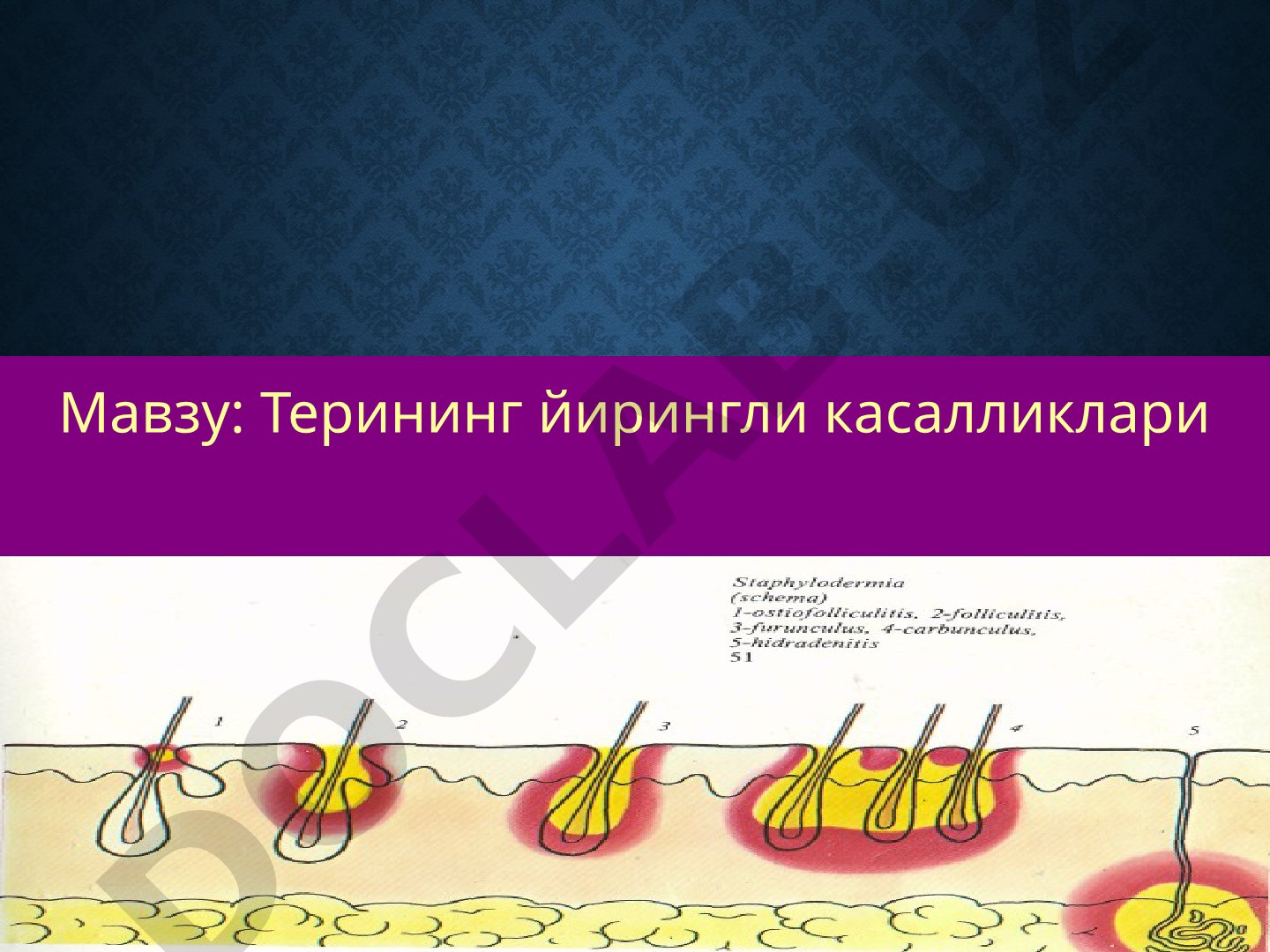 Терининг йирингли касалликлари - Пиодермитлар