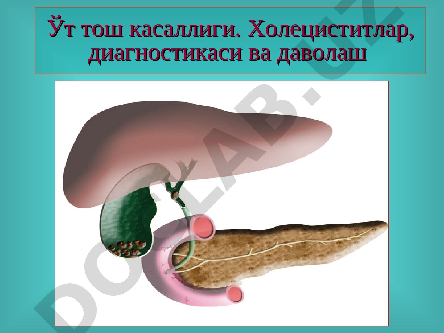 Ўт тош касаллиги. Холециститлар, диагностикаси ва даволаш